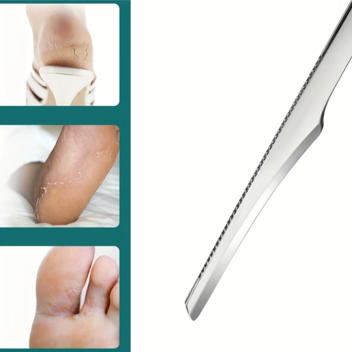 Professional 10-Piece Stainless Steel Pedicure Set - Complete Foot Care Tools for Salon-Quality Results at Home