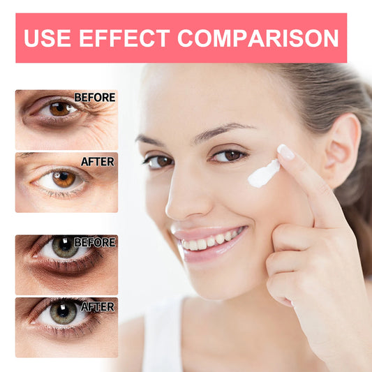 Eyes magician (Retinol for eyes free from auras)