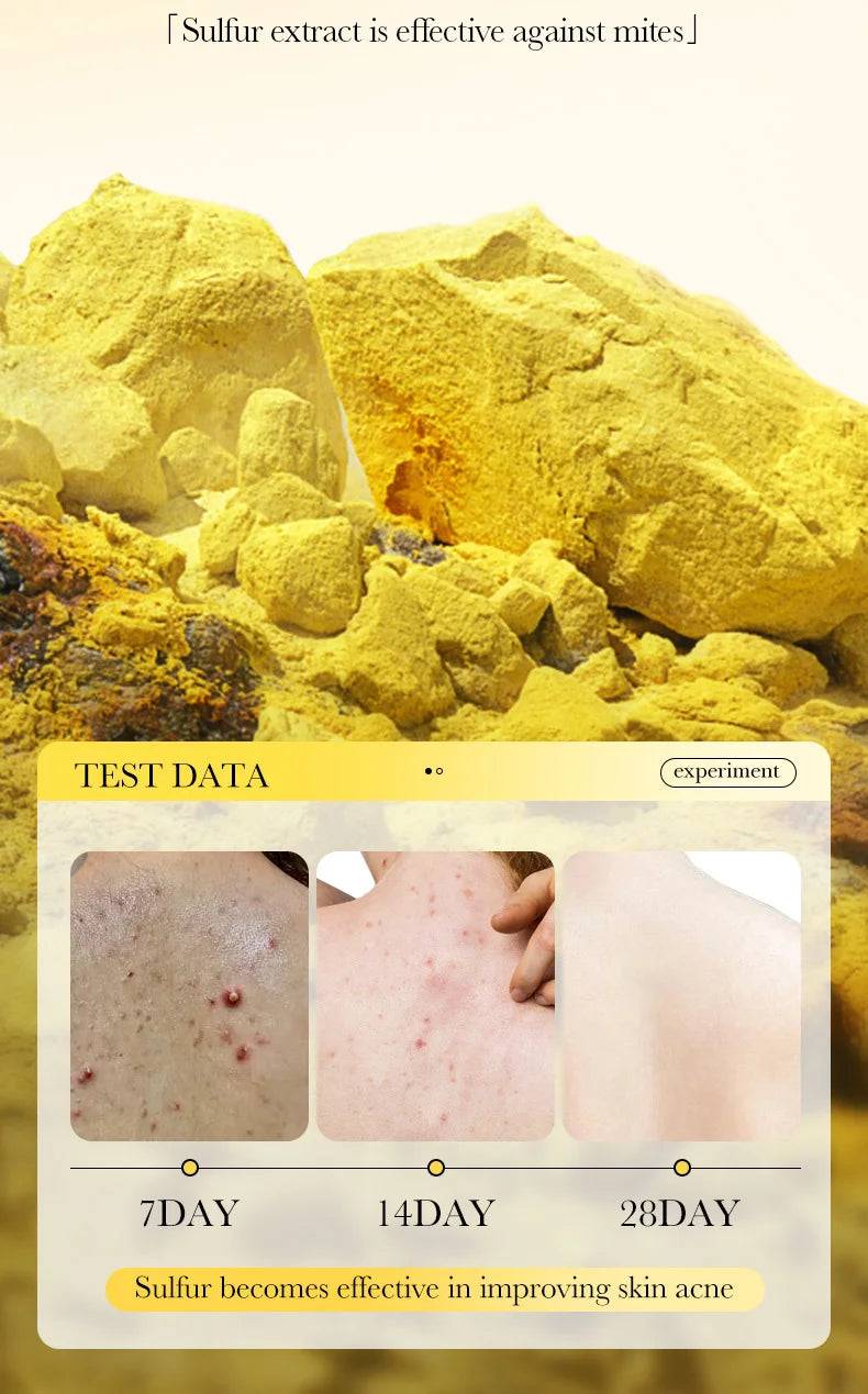 1/2pcs SADOER Sulfur Mite Removing Facial Soap Universal Handmade Soap for Body Face Wash Foam Moisturizing Facial Cleanser